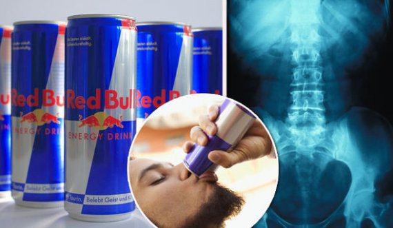 Çfarë i bën trupit tuaj vetëm një kanaçe Redbull