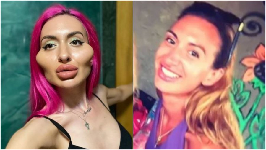Ka mollëzat më të mëdha në botë, por modeles i duken përsëri të vogla! Ja ç’mendon të bëjë