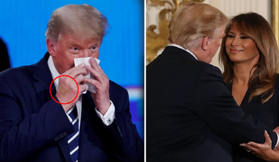Kamerat e kapin detajin, Donald Trumpit i ka lënë shenja koronavirusi