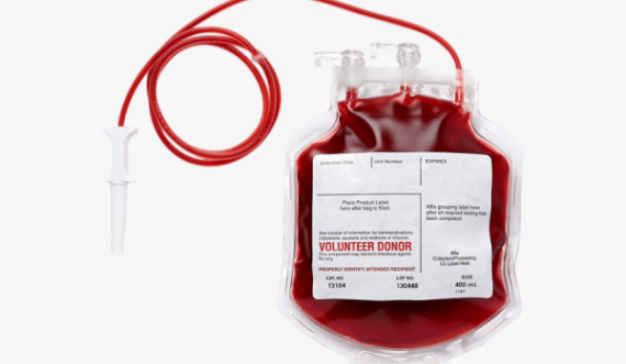 Qendra për Transfuzion kërkon grupin e gjakut A+
