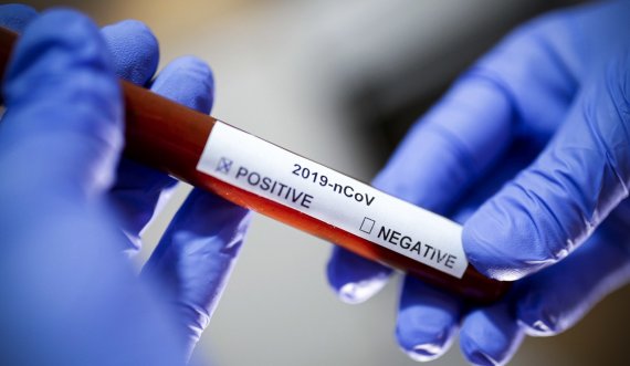 Çekia dhe Ukraina shënojnë rekorde të rasteve ditore të koronavirusit