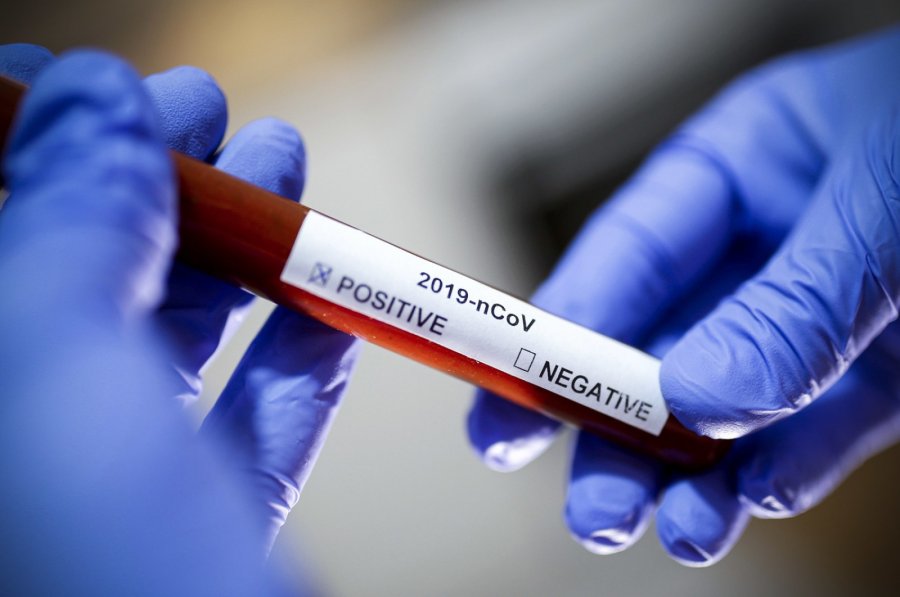 Çekia dhe Ukraina shënojnë rekorde të rasteve ditore të koronavirusit