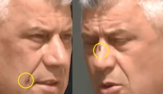 Miza ulet në hundën e Presidentit Thaçi