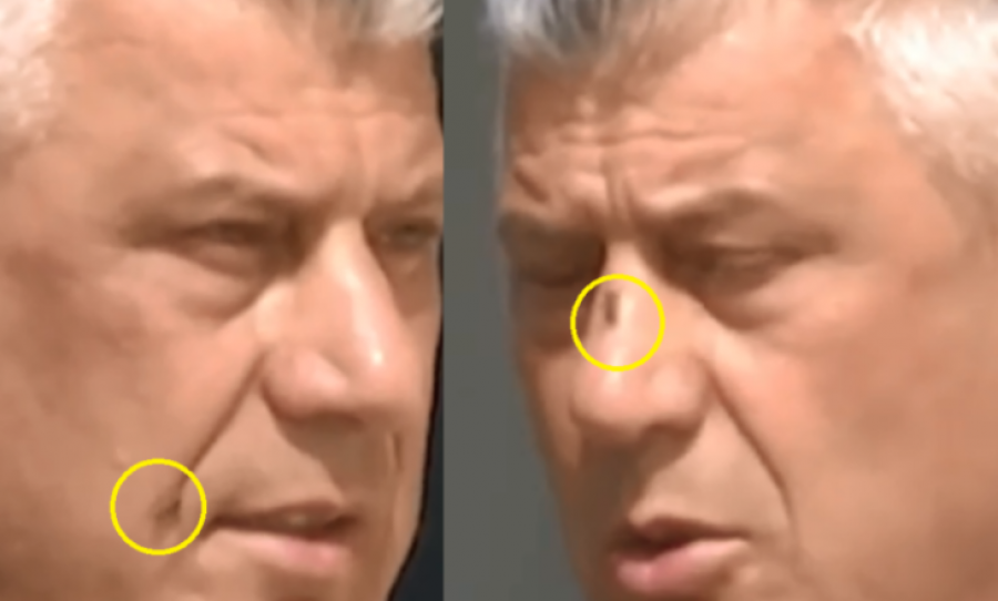 Miza ulet në hundën e Presidentit Thaçi