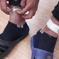 Avokati kosovar: Mbrëmë është rrahur nga policia një fëmijë dhe ende nuk është dërguar në QKUK