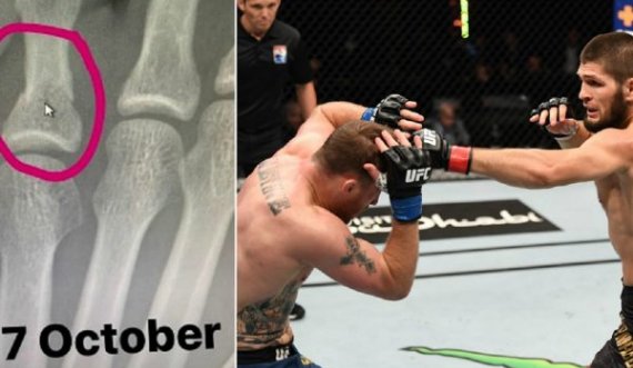 Khabib publikon dëshmi se e kishte thyer shputën e këmbës 3 javë para meçit me Gaethje