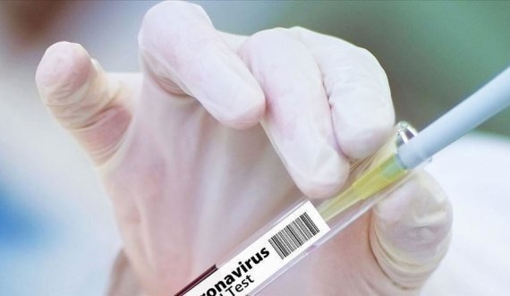 Ndodh në Prishtinë: Laboratori privat ua kryen testet PCR pacientëve në oborr, ankohen banorët
