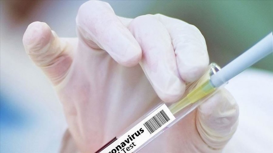 Ndodh në Prishtinë: Laboratori privat ua kryen testet PCR pacientëve në oborr, ankohen banorët