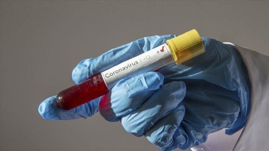 Bien shifrat e të shëruarve: Veç 48 persona mposhtin koroavirusigjatë 24 orëve të fundit