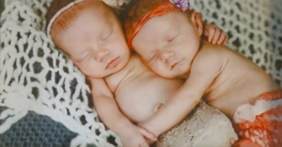 Ato lindën të kapura prej dore, ja si duken sot dy binjaket që habitën botën: Do mbeteni pa fjalë nga bukuria