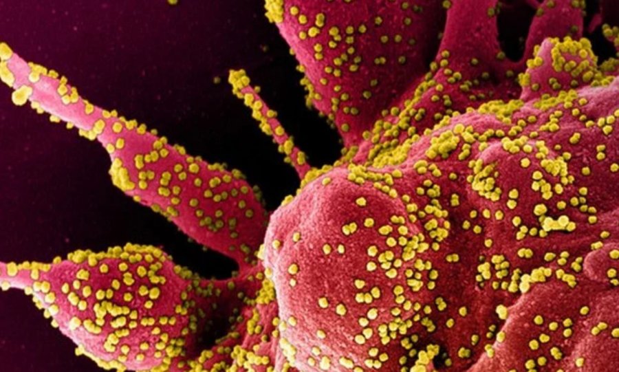 “Covid-19 mund t’i nxisë sistemet imunitare të pacientëve të sulmojnë…”, çfarë thotë studimi i ri