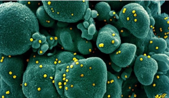 Studimi i ri tregon sa qëndron në trup koronavirusi nga momenti i infektimit