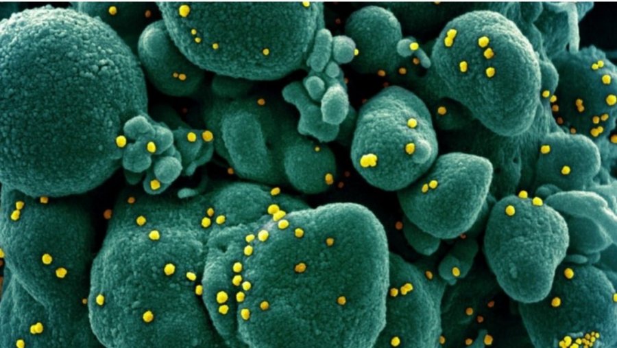 Studimi i ri tregon sa qëndron në trup koronavirusi nga momenti i infektimit