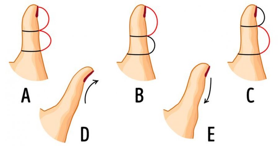 Cila është pika e veçantë në gisht? 