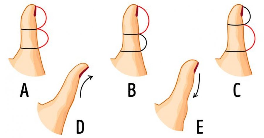 Forma e gishtit të madh të dorës mund të zbulojë shumë për personalitetin tuaj. Ja ç’duhet të dini