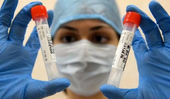 Në Slloveni regjistrohet rekord i rasteve të reja me Coronavirus