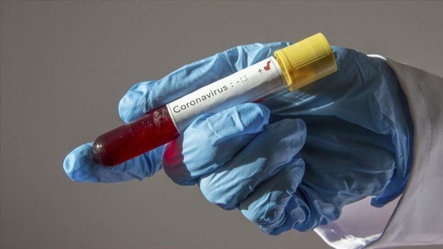 Indonezia shënon rekord të rasteve ditore të koronavirusit