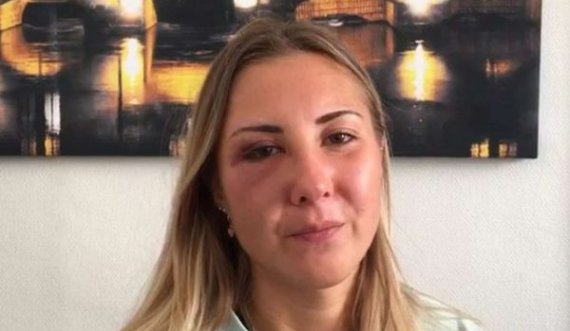 Studentja quhet prostitutë dhe grushtohet në fytyrë nga tre burra – se kishte veshur minifund
