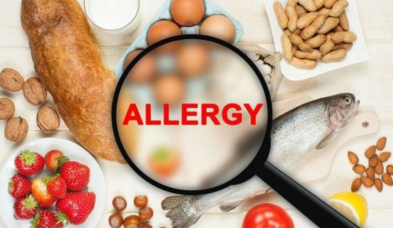 Ilaçet shtëpiake që trajtojnë alergjitë në ushqim 