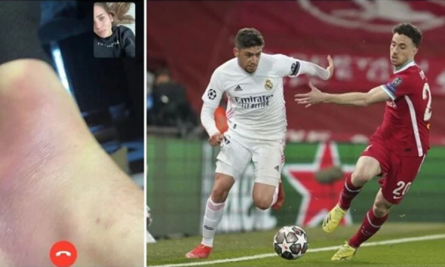 Pamje: Ylli i Real Madridit luajti i lënduar dhe me dhimbje kundër Liverpoolit