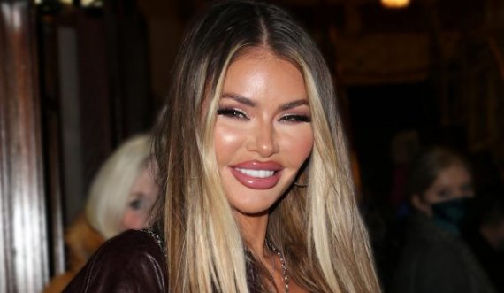 Chloe Sims i thotë lamtumirë botoksit, rikthen pamjen e saj natyrale