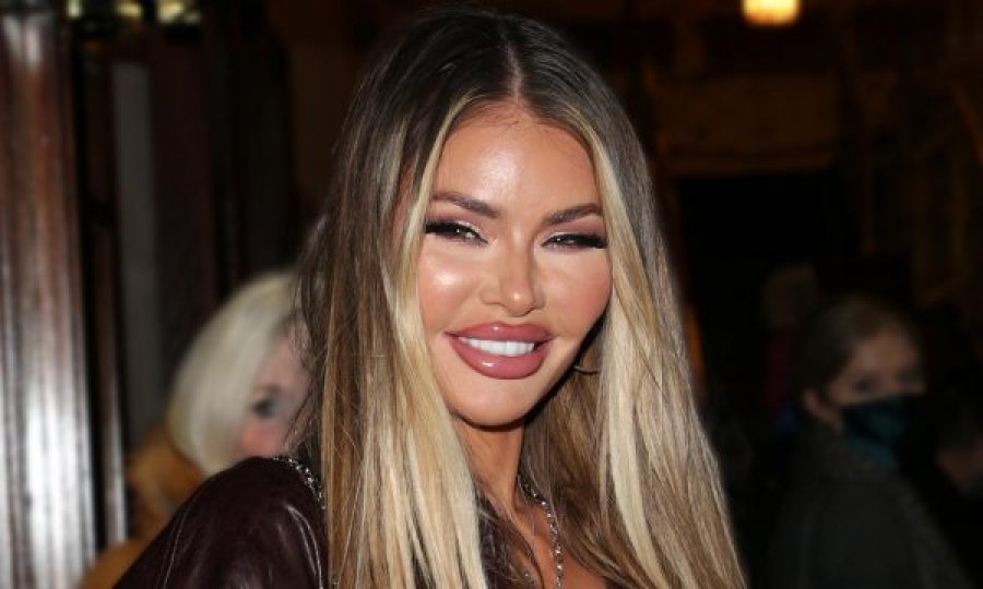 Chloe Sims i thotë lamtumirë botoksit, rikthen pamjen e saj natyrale