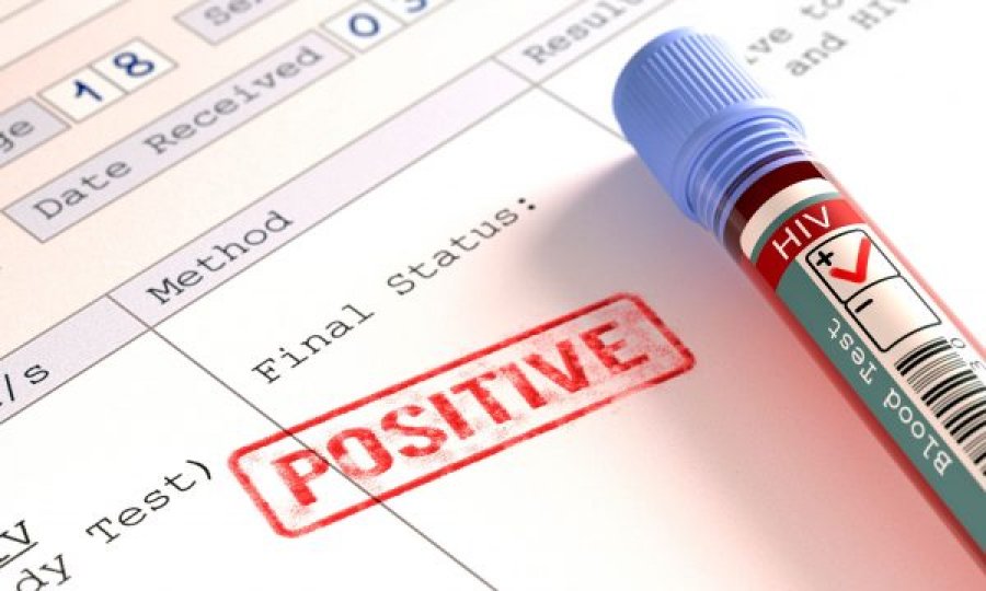 Rritet numri i pacientëve me virusin HIV, 1 mijë e 600 testime për 9 muaj