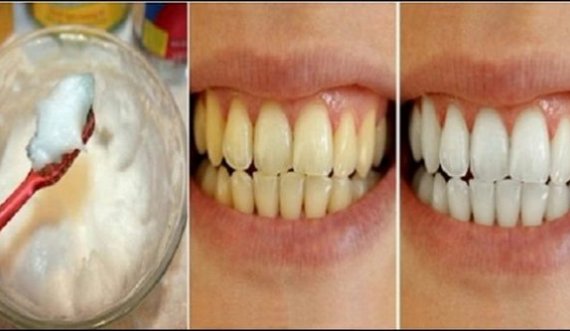 Disa mënyra për zbradhjen e dhëmbëve 