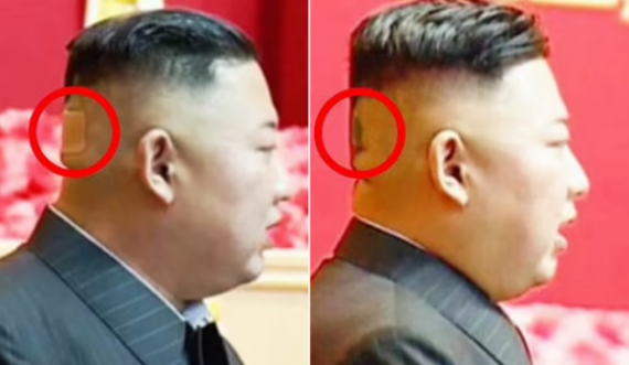  A është sëmurë? Kim Jong-un shfaqet me një njollë të zezë prapa koke 