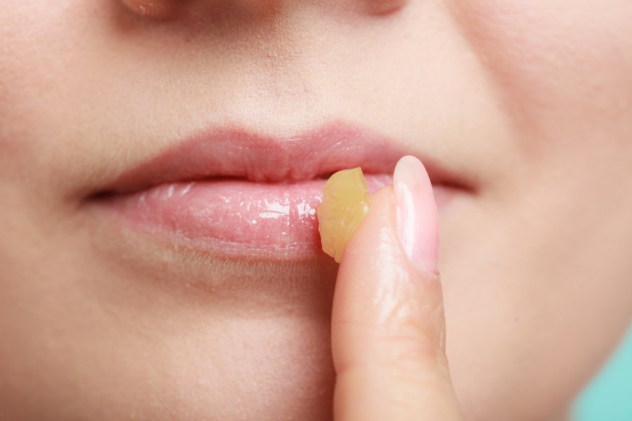 5 gjërat që buzët tuaja po përpiqen t’ju tregojnë për shëndetin