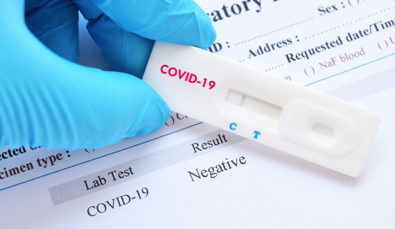  Arrestohen disa persona pasi falsifikuan teste negative të COVID-19 për mërgimtarët 