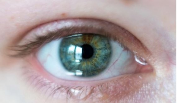 Faktorët që ndikojnë në lotimin e syve janë… Ja kur duhet të shqetësoheni sipas specialistëve