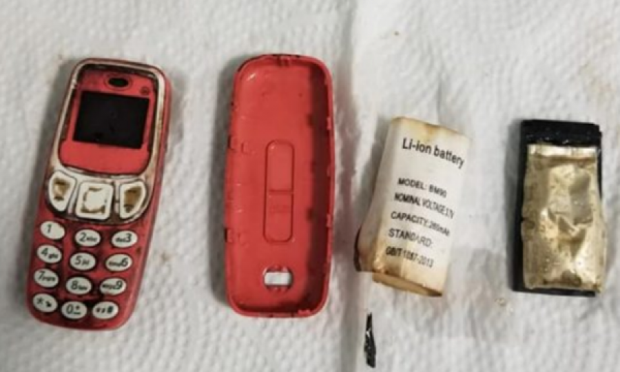33 vjeçari nga Kosova përpin telefonin, pamje se si i largohet nga trupi me ndërhyrje kirurgjike