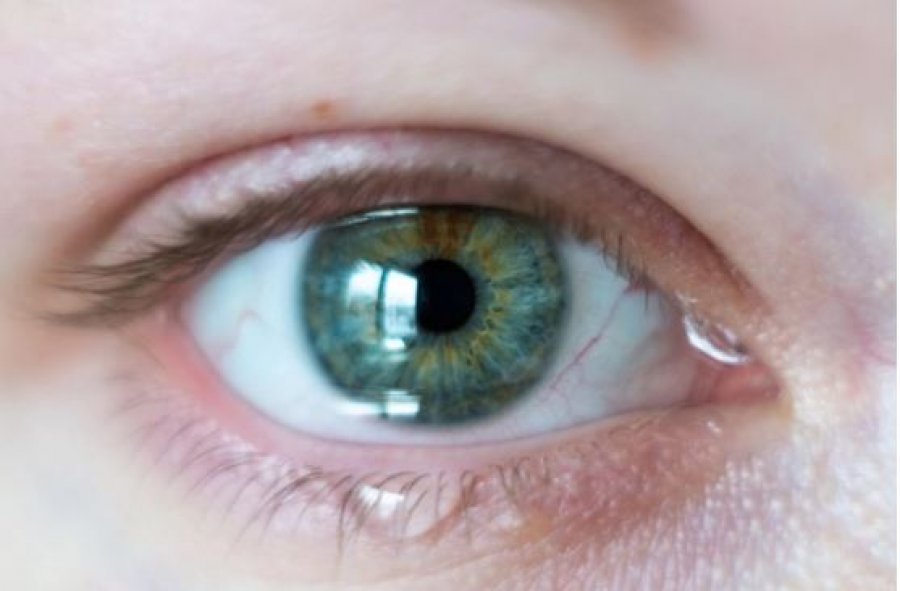 Faktorët që ndikojnë në lotimin e syve janë… Ja kur duhet të shqetësoheni sipas specialistëve