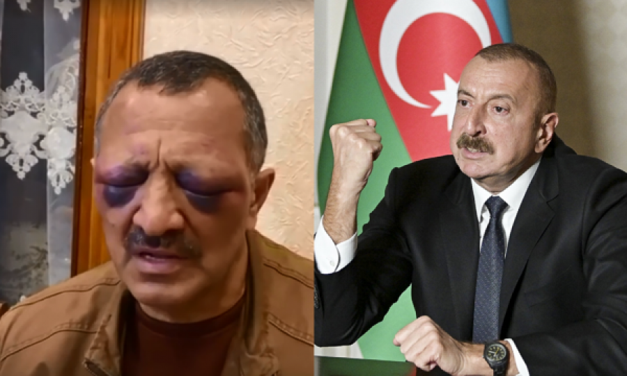 Pamje: Aktivisti opozitar azer s’mund t’i hapë sytë nga rrahja, fajëson policinë