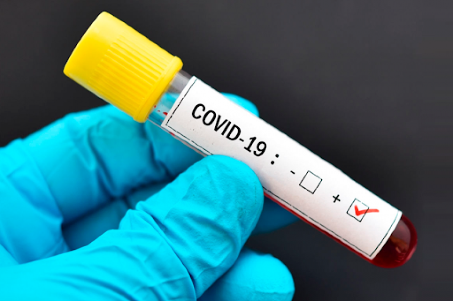 Sa të saktë janë testet e shpejta për COVID?