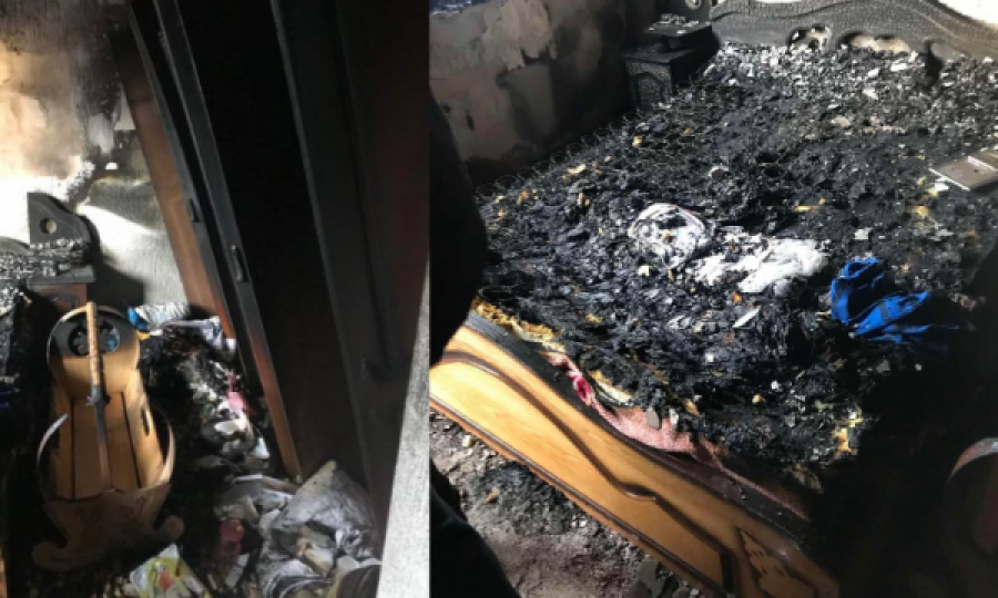 Vdes 3-vjeçari që pësoi djegje të rënda pasi shtëpia ku jetonte u përfshi nga zjarri