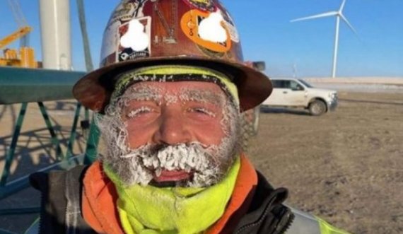 Kështu duket fytyra e një njeriu pas një dite pune në temperaturë prej minus 49 gradë Celsius