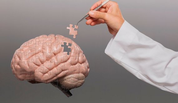 Shkencëtarët zbulojnë mënyrën e diagnostikimit të hershëm të Alzheimer-it dhe Parkinson-it