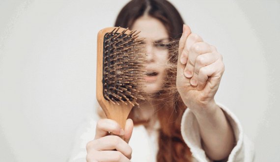 Rënia e flokëve pas Covid-19, dermatologia këshillon se çfarë duhet të bëjmë