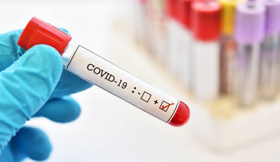 Bie numri i infeksioneve me COVID-19 në Gjilan