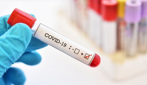 Edhe sot më shumë të shëruar se të infektuar me koronavirus
