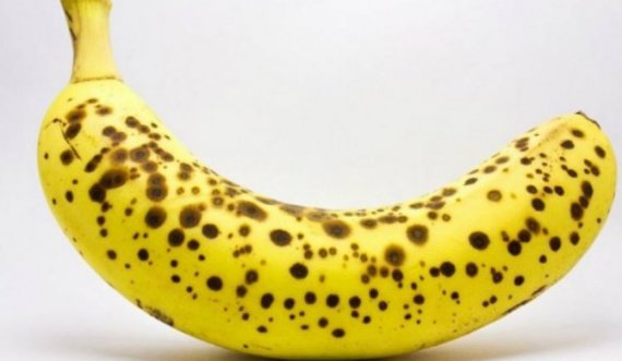 Bën mrekulli, ja përse duhet të hani çdo ditë banane me lëkurë të errët