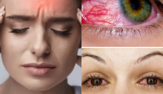 Lloji i ri i COVID-19: Këo janë tri simptomat që shfaqen në sytë tuaj