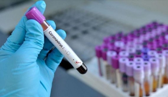 Lajmi i fundit: 9 të vdekur dhe 294 raste të reja me koronavirus në Kosovë