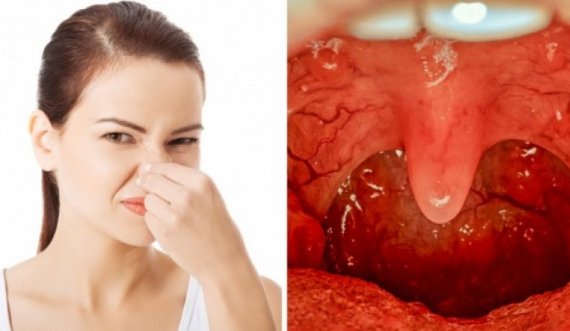 Si të hiqni qafe aromën e pakëndshme nga goja