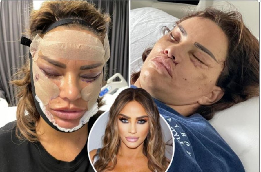 Katie Price zbulon operacionin brutal estetik