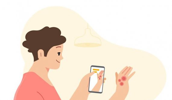 “Google” vjen me një aplikacion të ri që njeh deri në 288 sëmundje të lëkurës, flokëve dhe…