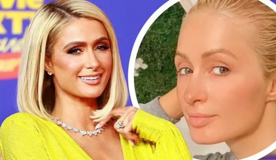 Paris Hilton thotë se nuk ka përdorur asnjëherë botoks