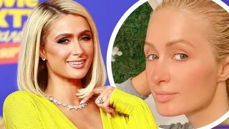 Paris Hilton thotë se nuk ka përdorur asnjëherë botoks